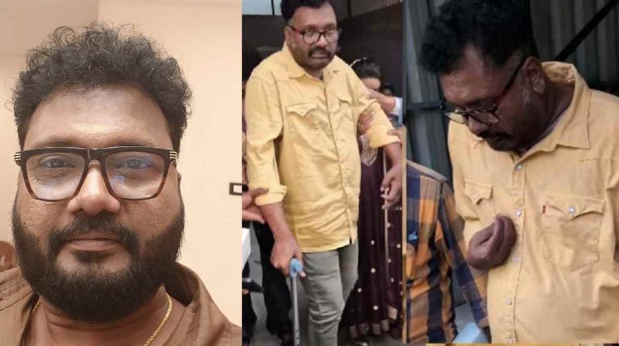 തെറാപ്പി ചെയ്താലേ ഇനിയും ആരോഗ്യവാനാകൂ. തത്ക്കാലം തെറാപ്പി മുടങ്ങി നിൽക്കുകയാണ്. സാമ്പത്തികമാണ് കാരണം.
